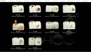 Menu Phô 2 - Les neiges roll